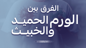 الفرق بين الورم الحميد والورم الخبيث