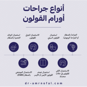 ما أنواع جراحات أورام القولون؟