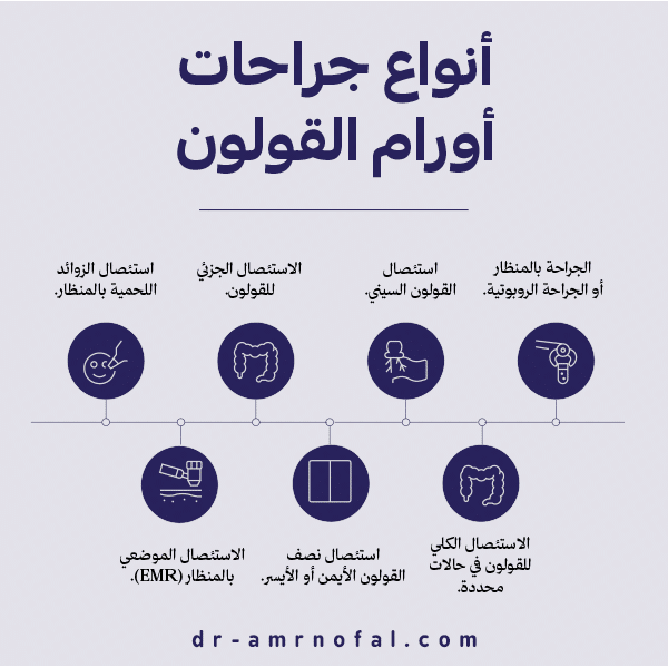 ما أنواع جراحات أورام القولون؟