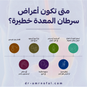 متى تكون أعراض سرطان المعدة خطيرة؟